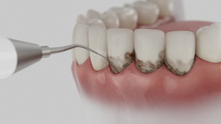 Reliable Dental contractor in Flagtown, NJ by Dentist Open Now